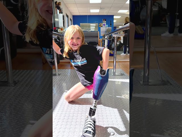 7-Year-Old Amputee Gets a New Prosthetic Leg in One Day | Capri’s Story