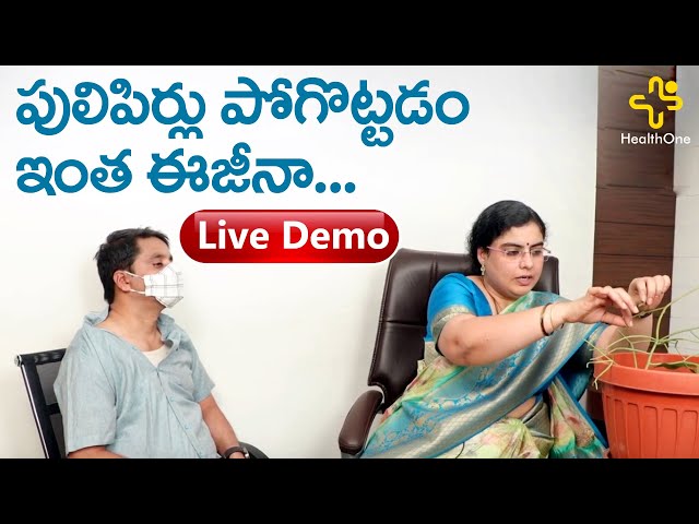 పులిపిర్లు పోగొట్టడం ఇంత ఈజీనా..! Unani Treatment for Warts | by Dr. S.G.V Sathya | TeluguOneHealth