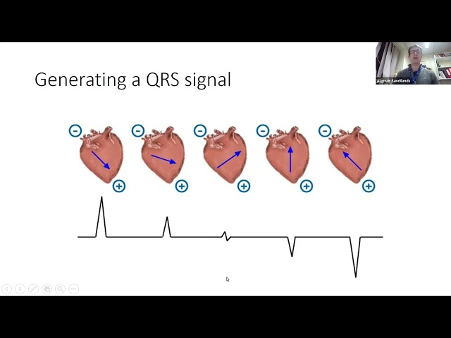 Basic ECG signals