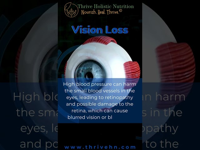 Health Risks of High Blood Pressure