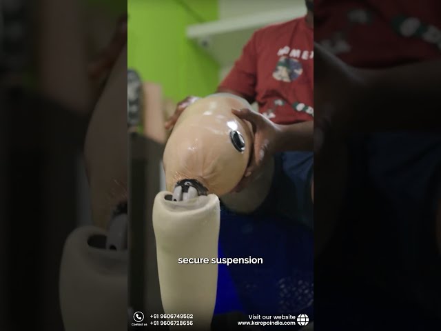 🦿 IT’S NOT JUST AN ARTIFICIAL LEG…