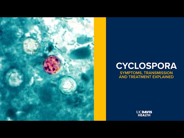 Cyclospora Parasite Outbreak: Symptoms, Treatment and How It Spreads | UC Davis Health