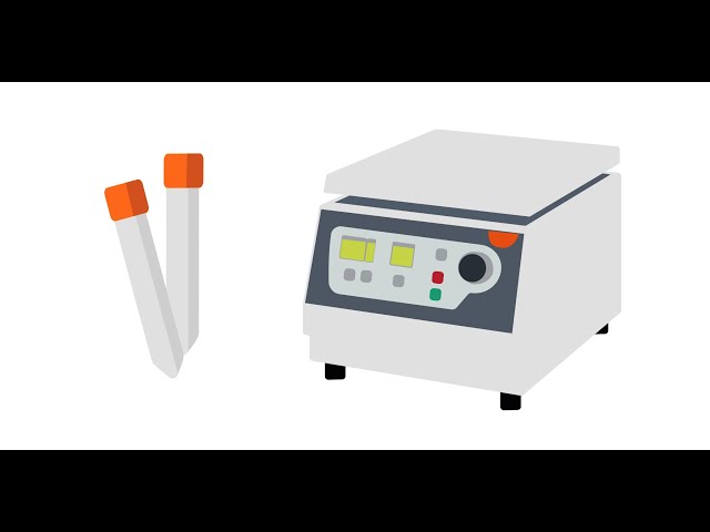 5 Tips for Better Centrifugation
