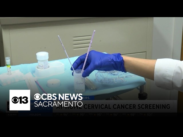 UC Davis Health pilot program offers at-home cervical cancer screenings