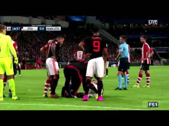 Luke Shaw Horror Injury vs PSV Broken Leg