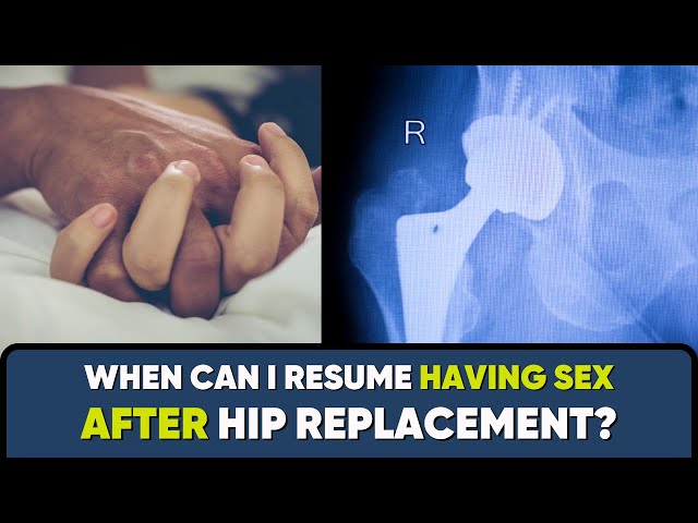 When can I have SEX AFTER Total Hip Replacement Surgery? #hipreplacementrecovery
