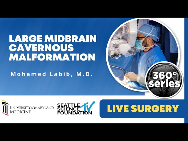 Skull Base 360°:  Large Midbrain Cavernous Malformation - Mohamed Labib, M.D.