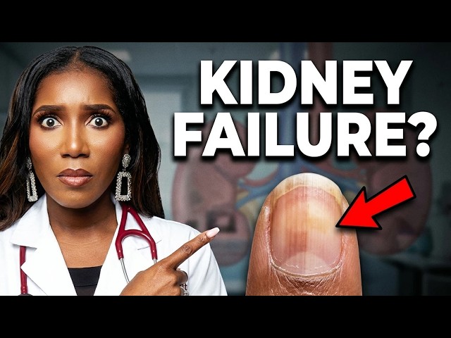 Kidney Disease Warning Signs Your Nails Are Telling You - No. 4 Is Sneaky!