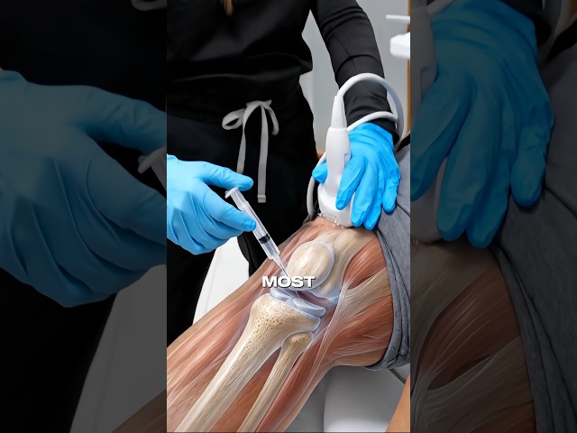 How to relieve chronic knee pain? #kneepain #painmanagement