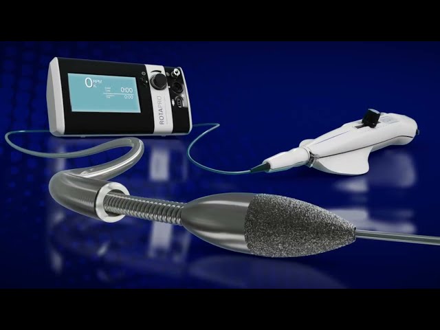 ROTAPRO™ System Mechanism of Action | Calcium Modification in PCI
