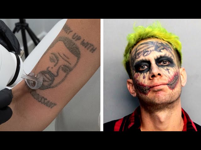 Would You Get These Regrettable Tattoos Removed?