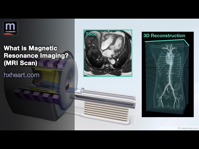 What is Magnetic Resonance Imaging? (MRI Scan) - Medmovie Hx Heart Library - hxheart.com