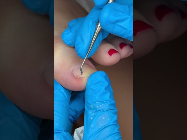 Pedicure at Home by Me - Satisfying Process🔊💆‍♀️