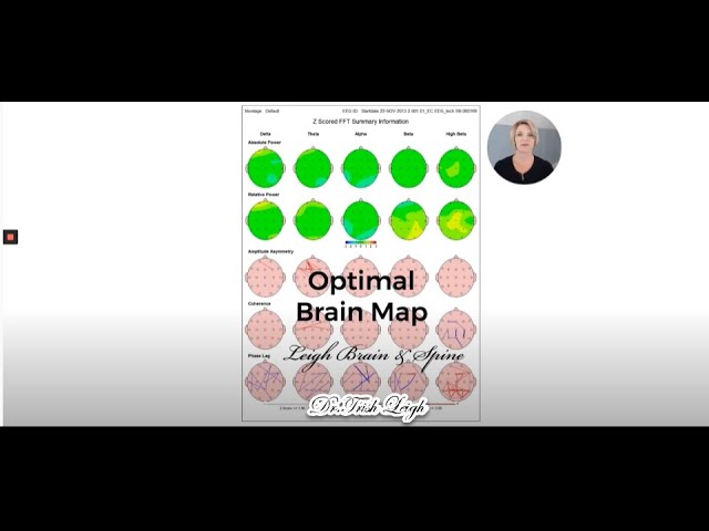How to Interpret Your qEEG Brain Map.