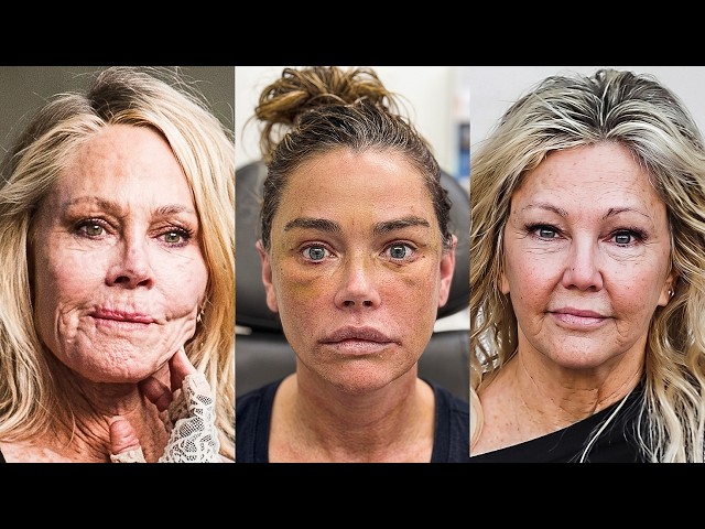 50+ Celebs Whose Facelifts Went Too Far | Then and Now Photos 2026