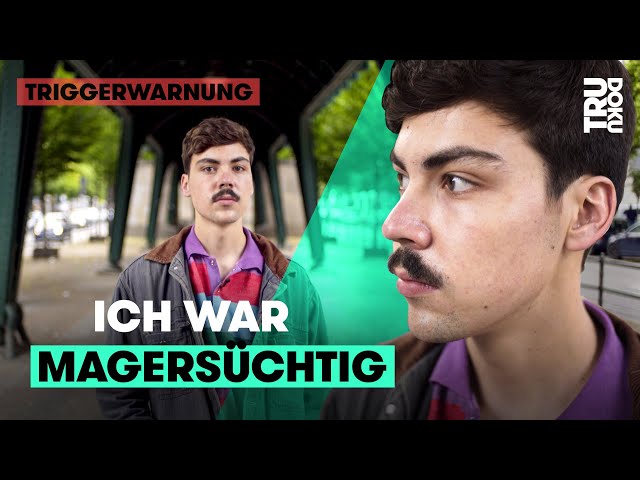 Magersucht: Wie die Essstörung Arons Leben bestimmte I TRU DOKU