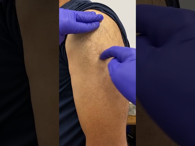 MHE Z Track Technique for IM Injections