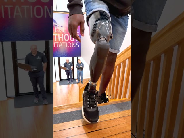 Walking with an Above-Knee Prosthetic Leg | Daniel