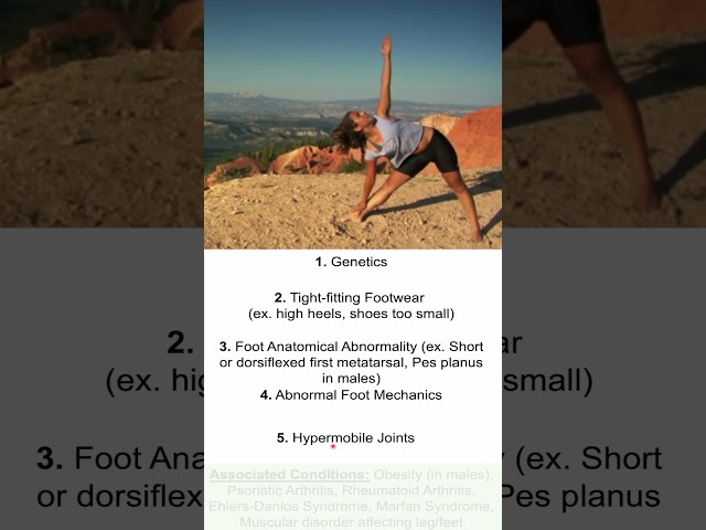 Bunions (Foot Deformity) Risk Factors & Causes