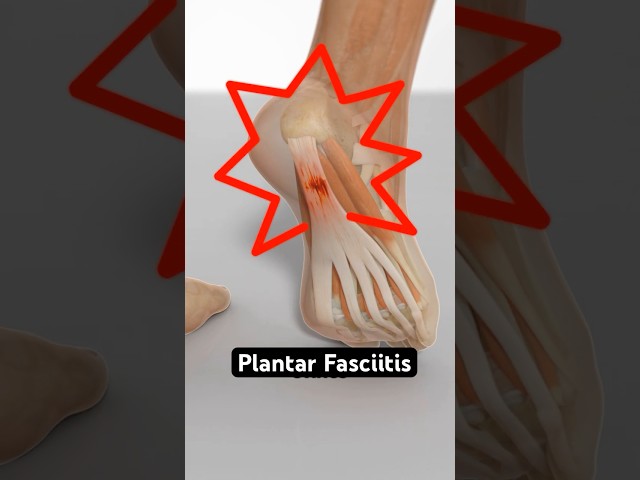 Why Your Heel Hurts First Thing in the Morning