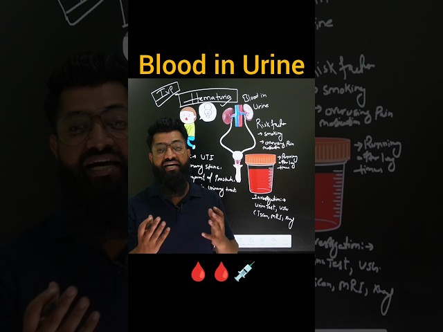 🩸💉 Blood In Urine #medical #science #medicalstudent #mbbs #urine #urethra #renaldisease #education
