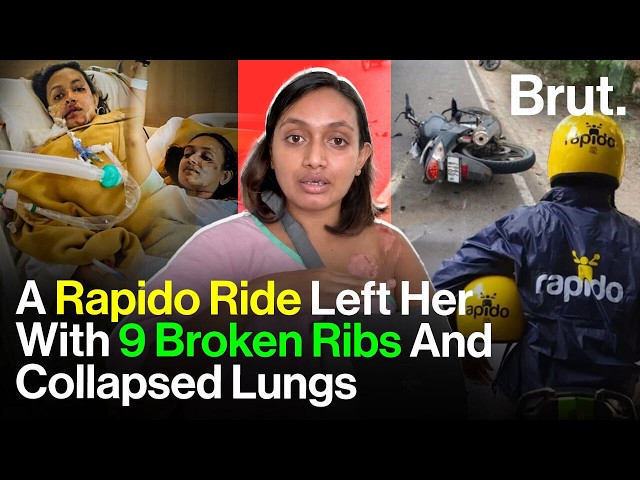 Rapido Ride Leaves Bengaluru Woman With 9 Broken Ribs, Rs. 20 Lakh Medical Bill