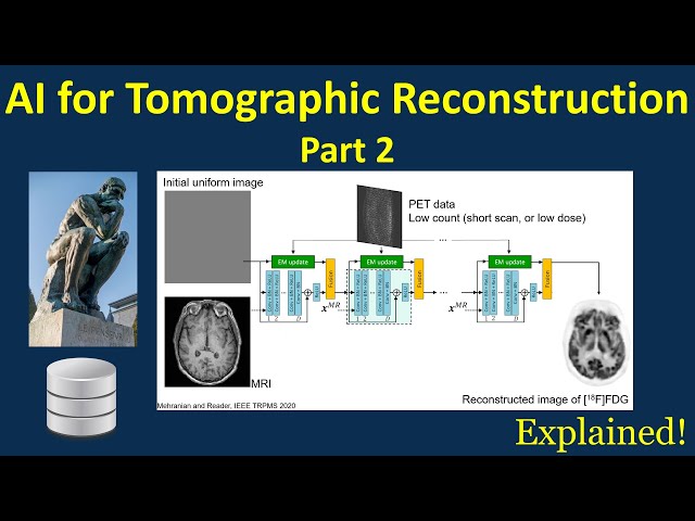AI for Tomographic Reconstruction: Part 2, Deep Learning within Iterative Reconstruction