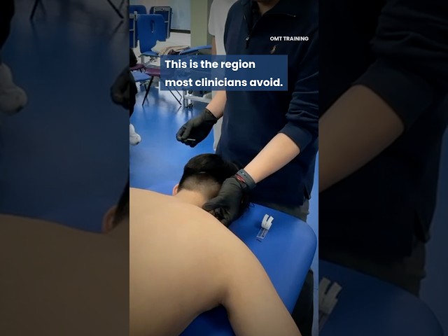 Acupuncture into the neck #acupuncture #dryneedling