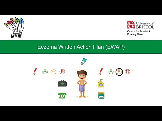 Eczema Written Action Plan (EWAP)