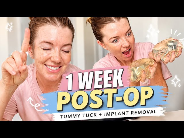 1 Week Post Op Tummy Tuck + Implant Removal in Bangkok 🇹🇭 | Recovery Update
