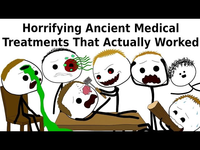 Horrifying ancient medical treatments that actually worked