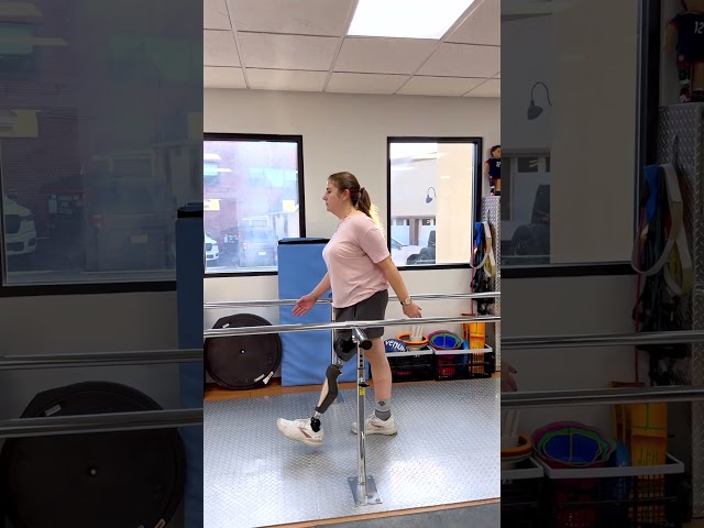 Above-Knee Amputee Gains Independence with Custom Prosthesis