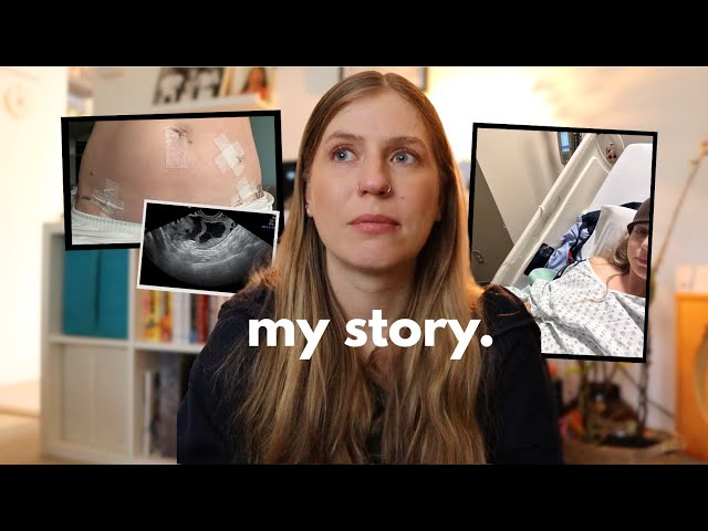 I had an emergency Ovarian Cyst surgery.