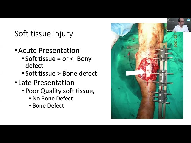 Soft Tissue Reconstruction & Ilizarov