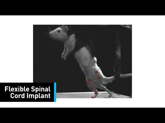 Meet the Spinal Implant That Could Help Paralyzed People Walk
