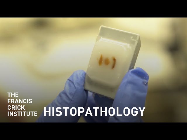 What Is Histopathology?