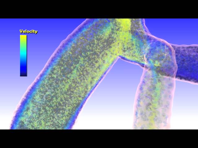 ScienceVisuals/Visualbiotech - "Computational Multiscale Hemodynamics"