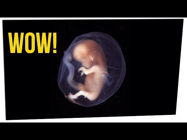 Baby Born 4 Years After Parents Pass ft. Bobby Lee & Khalyla Kuhn
