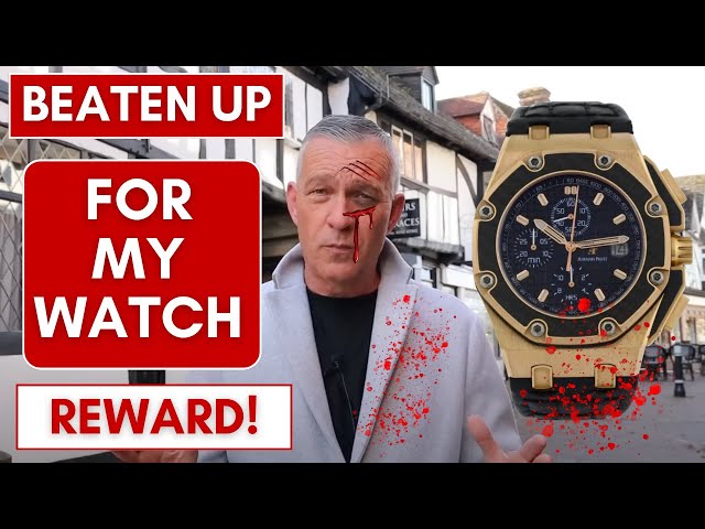 Beaten up for my Watch - SHOCKING TRUE STORY