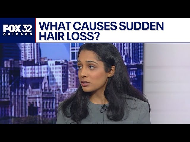 Understanding alopecia areata: What causes sudden hair loss?