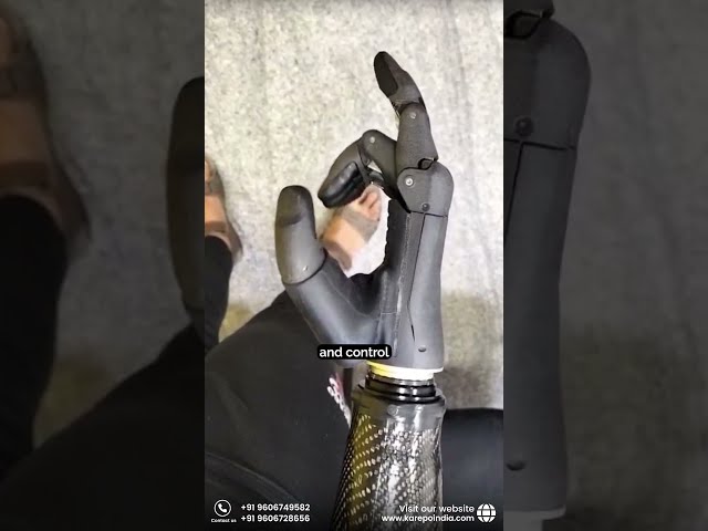 Two Prosthetic Hands. A Difference You Can Feel.