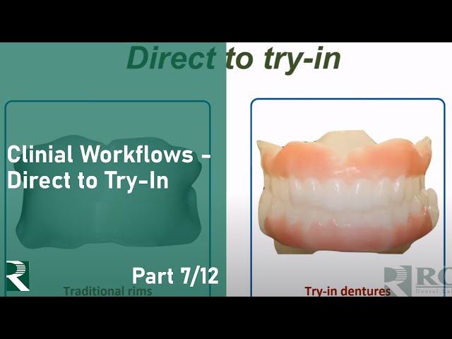 Transition Toward Digital Dentures: Clinical Workflows - Direct to Try-In (7/12)