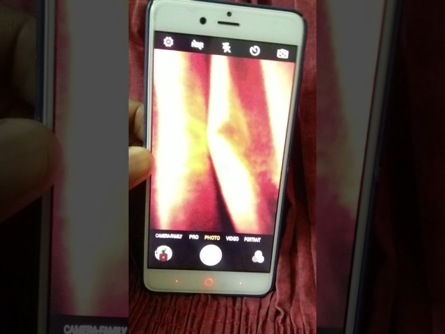 Ressurection remix rom for Zte Z17 mini