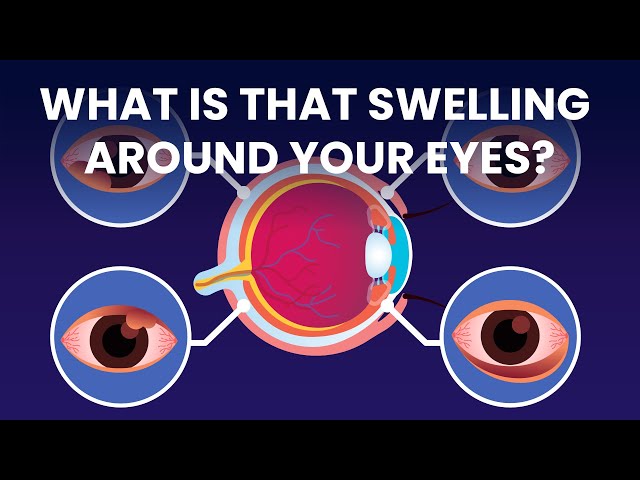 These Diseases Can Make Your Eyes Miserable