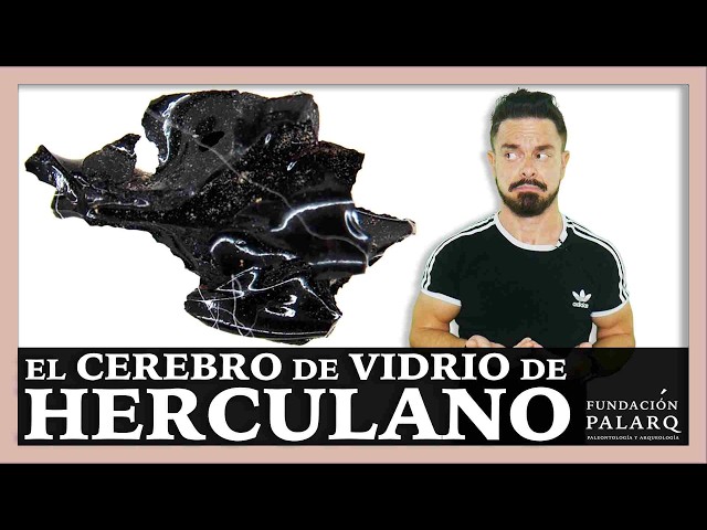 🧠 It Wasn’t Obsidian: It Was a Human Brain Turned Into Glass