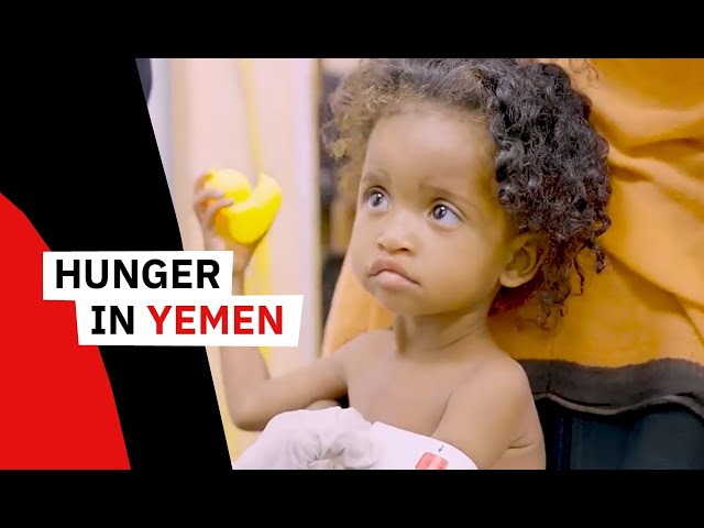 Hunger in Yemen: A Message from Asma Al-Atfi