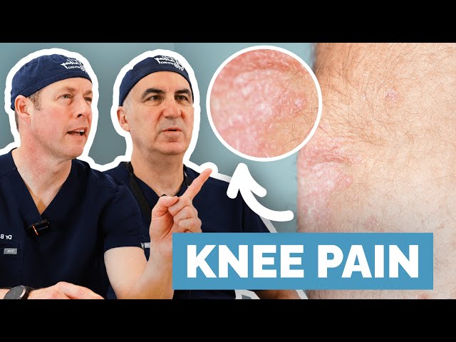 Are Cortisone Injections Safe?  Surgeons Explain