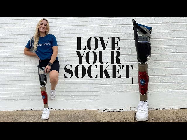 Amputee Gets Martin Bionics Socket-less Socket