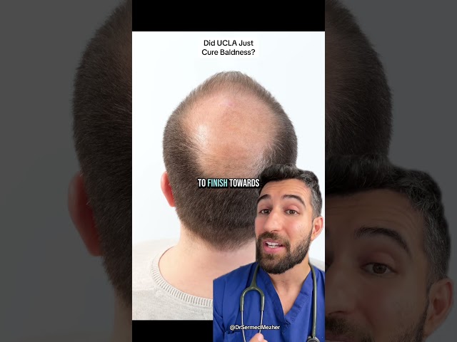 Scientists Might Have Just Cured Male Pattern Baldness #how