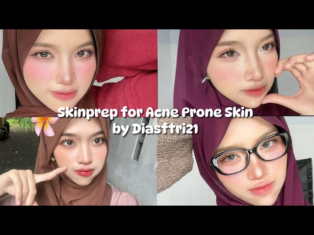 Skinprep for Acne Prone Skin @diasftri21